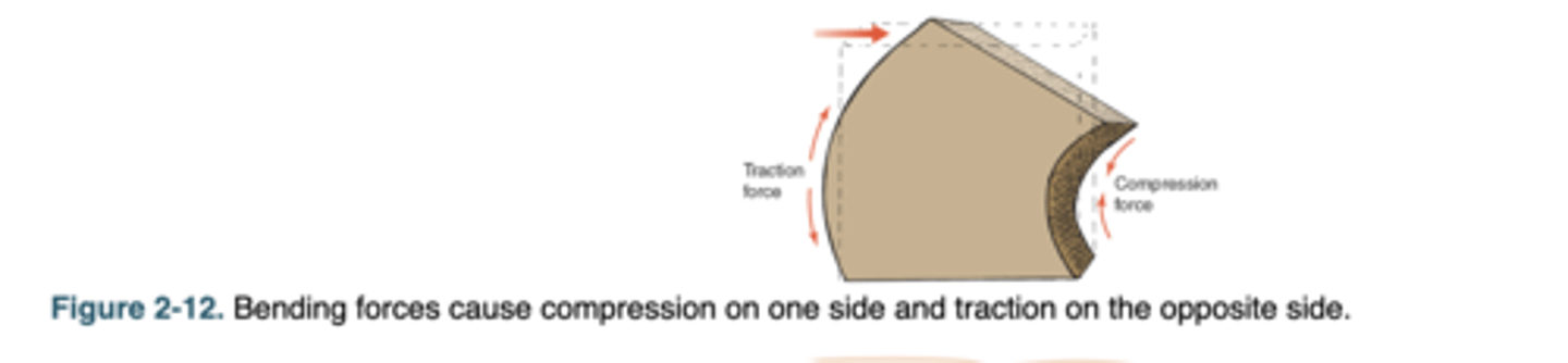 <p>occurs when a force is applied off the central axis of a long bone, creating compression on one side and traction on the other.</p>