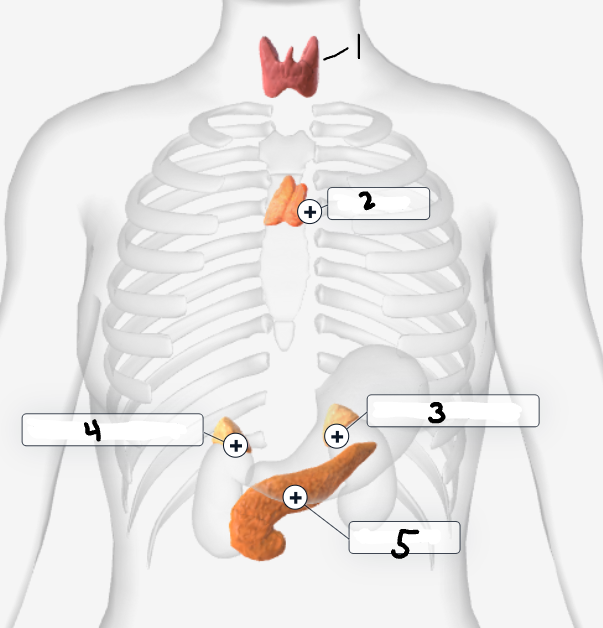 <p>Label the image</p>