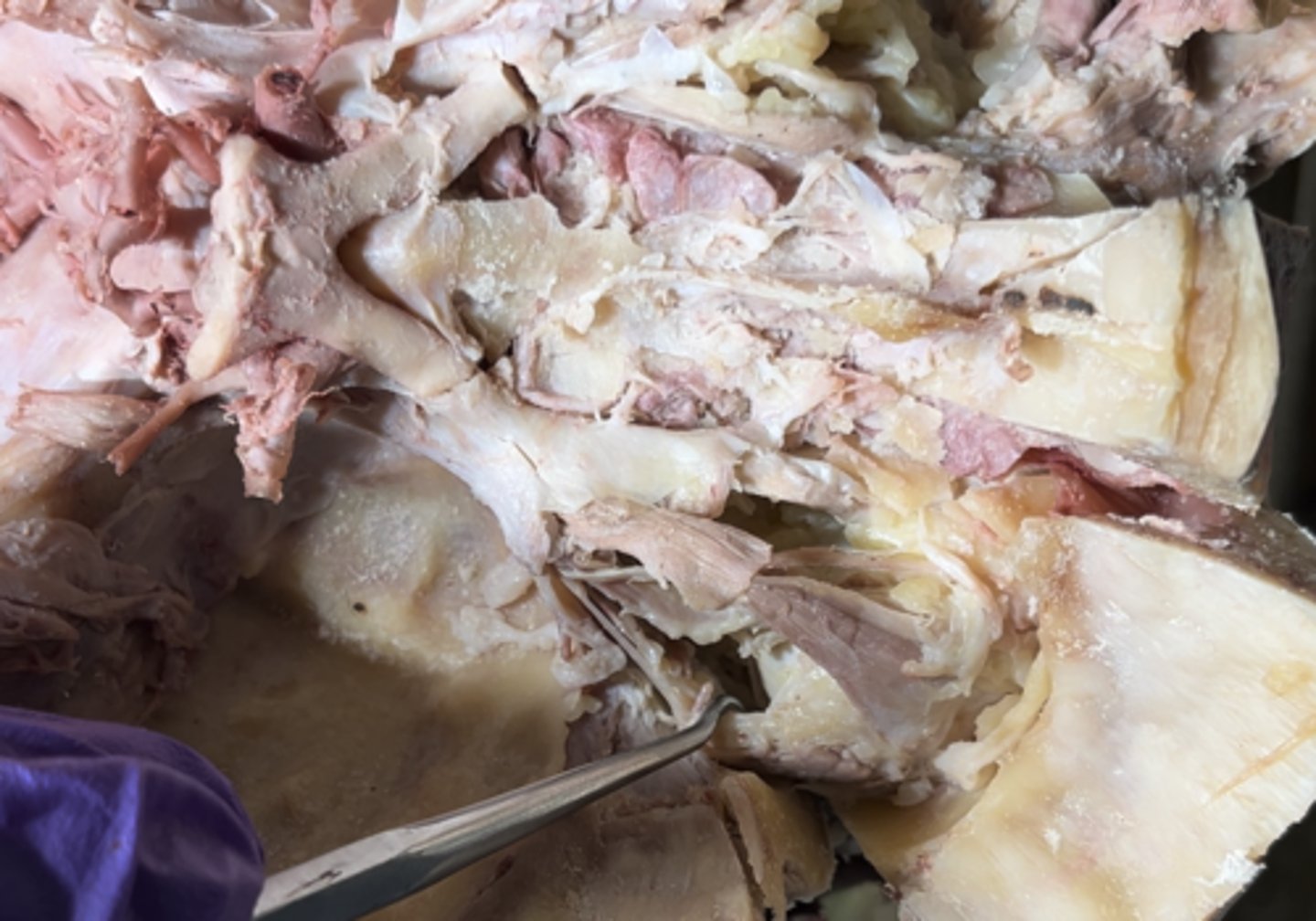 <p>On the lateral side of the eye the muscle is the</p>