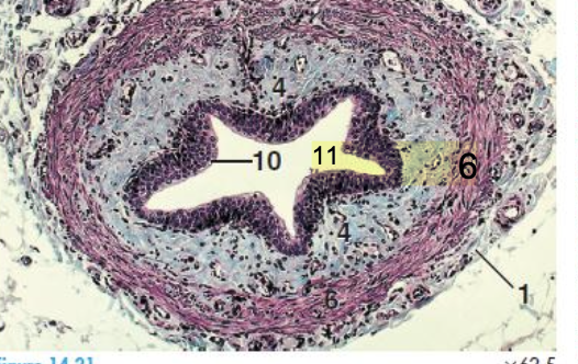 <p>what is the histology slide showing?</p>