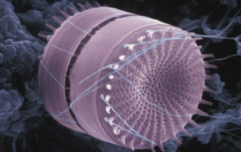 <p>What is this organism?</p>