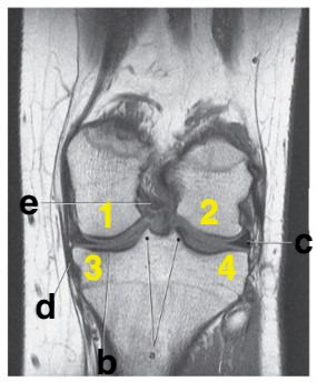 <p>Which letter is pointing to the posterior cruciate ligament?</p>