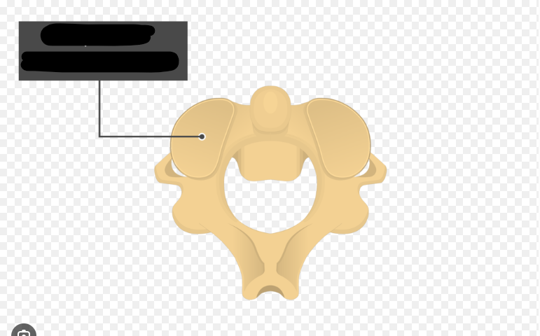 <p>what structure is this </p>