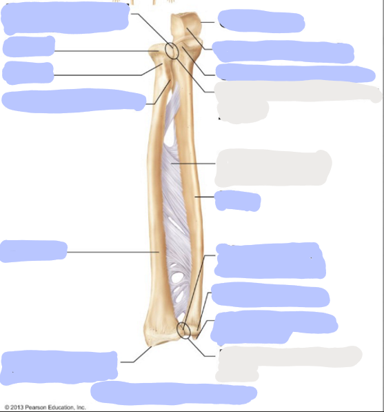 <p>Where is the <strong>Radial Styloid Process</strong>?</p>