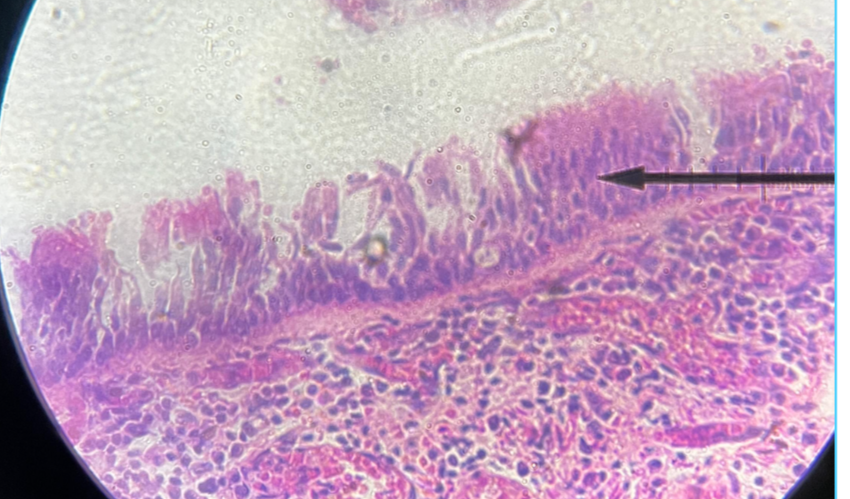 term image