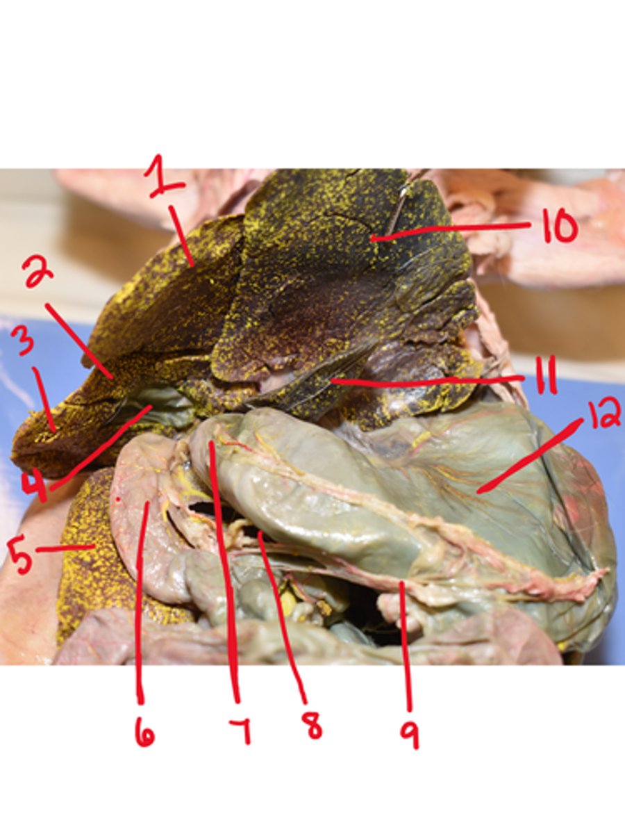 <p>What is structure #1</p>