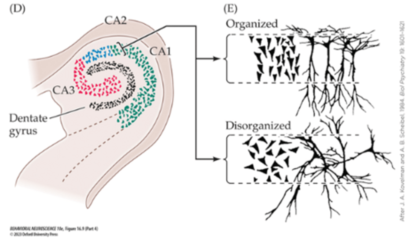 <p>Schizophrenia</p>