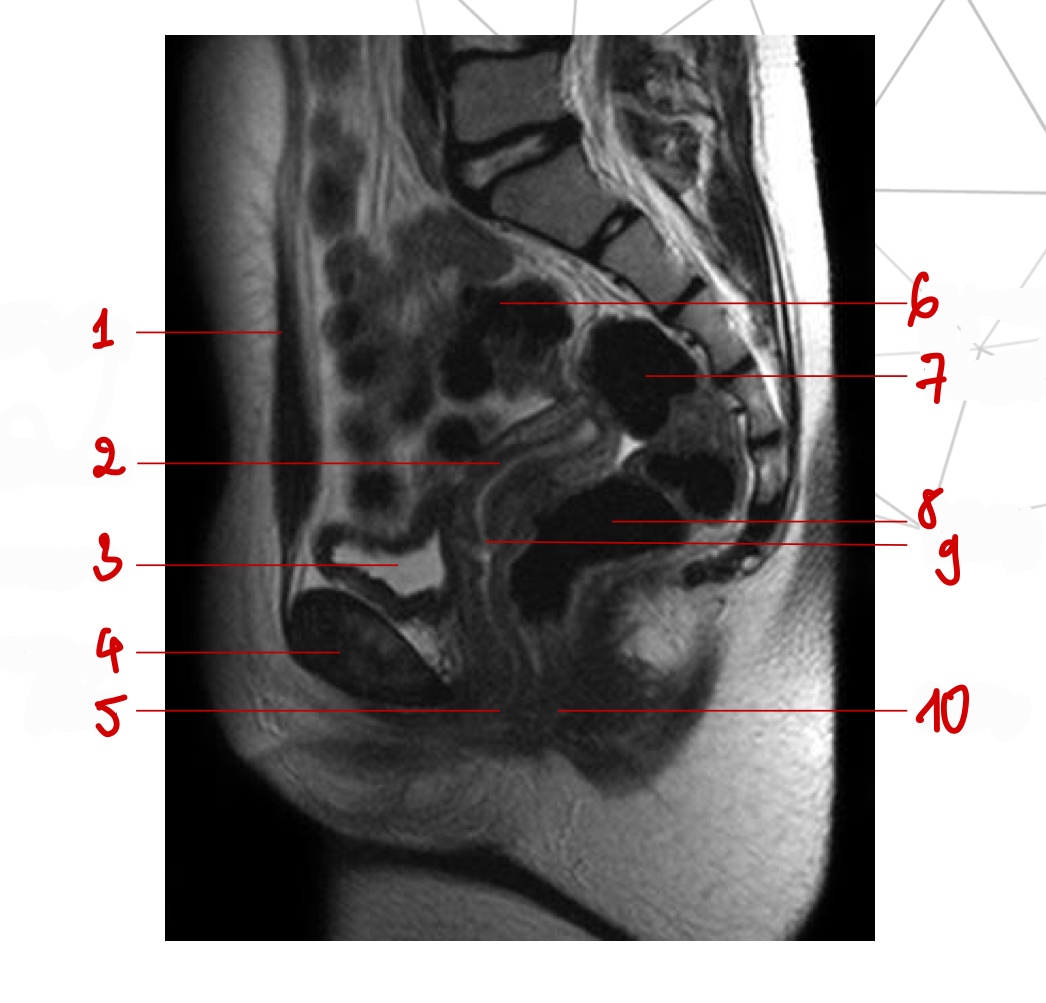 <p>Nêu chuỗi xung, mốc gp, thì</p>