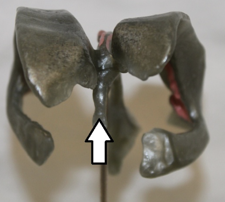 <p>identify the structure/cavity</p>