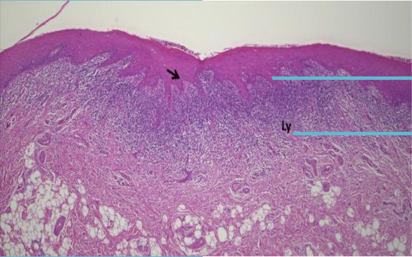 <p>Label from top to bottom and diagnose</p>