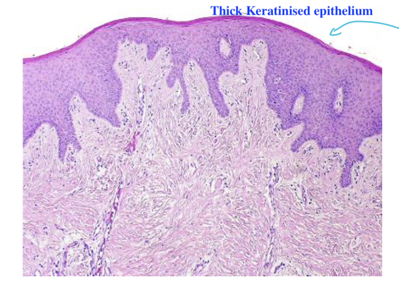 * **Keritinised oral mucosa**
* **Dentogingival junction -  Zone of attachment between ggingiva and enamel - ceiling of tooth prevents periodontal diseases**
* **Ggingival sulcus** 