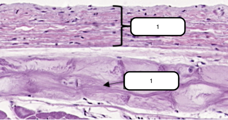 <p>Simple squamous epithelium formed by a single layer of flattened cells on the free surface of the endocardium.</p>