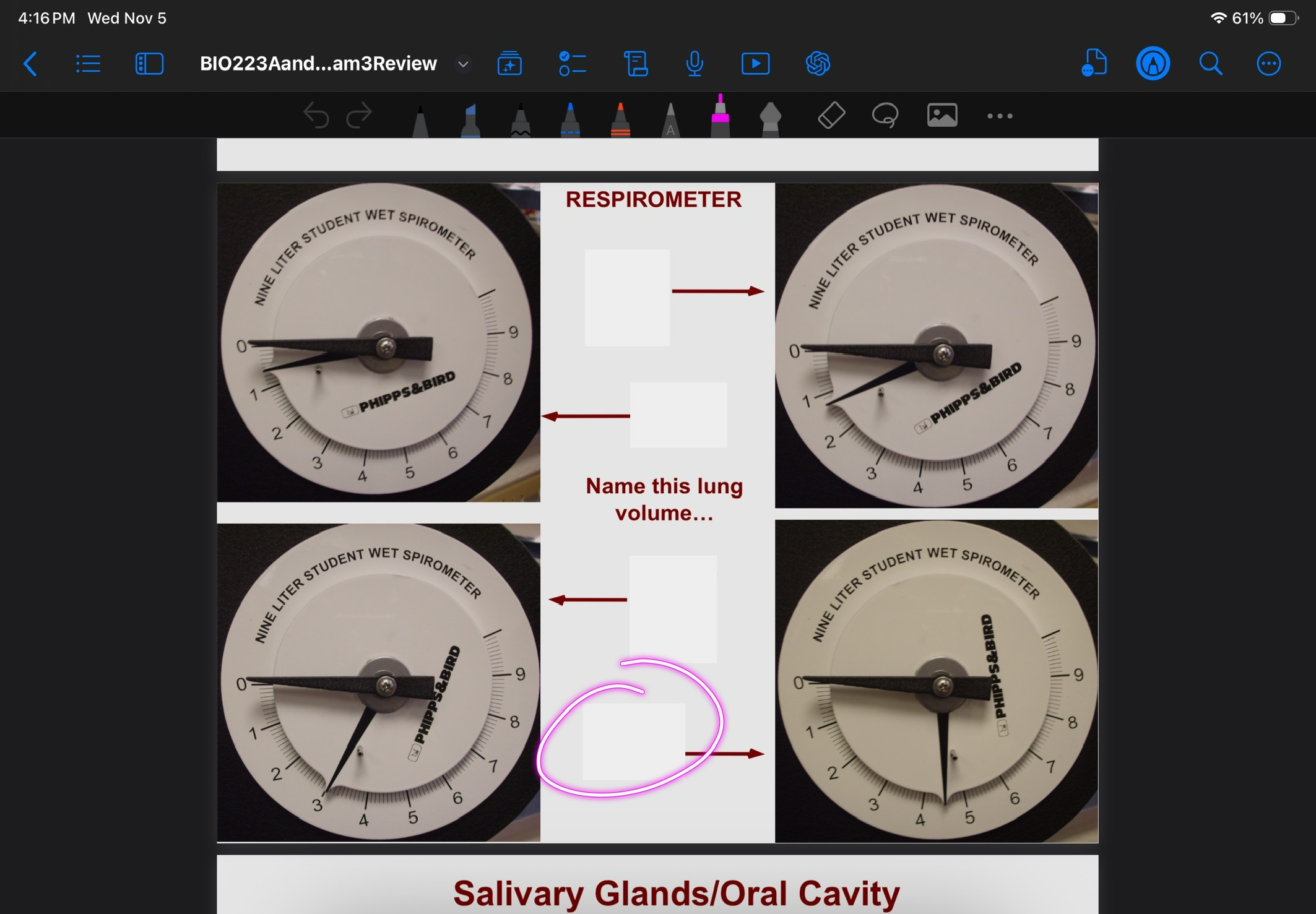 <p>Lung volume of VC</p>