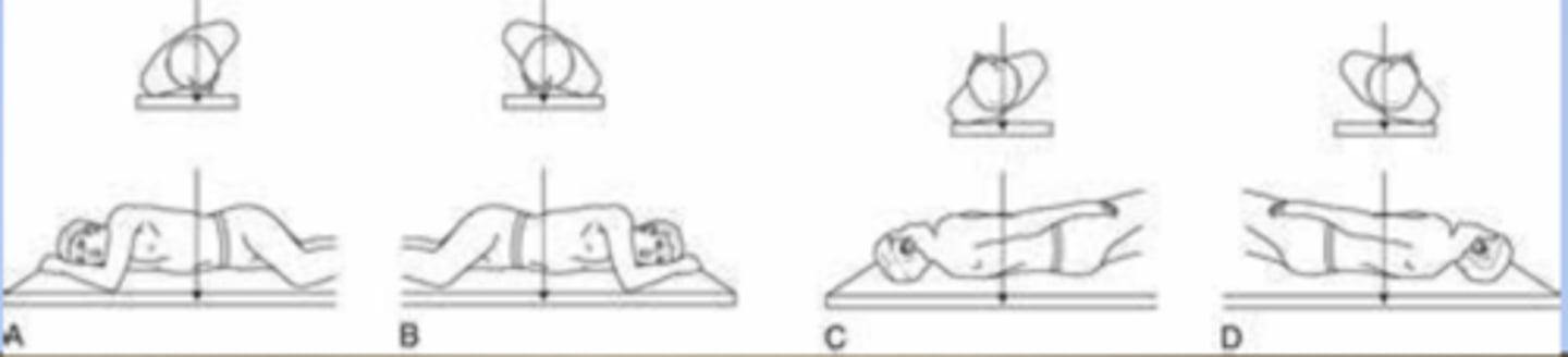 <p>Body is rotated so that the coronal plane is not parallel with the table or IR</p><p>angle of rotation is specific for anatomy of interest</p><p>named according to side and surface of body closer to table or IR</p><p>abbreviations: RPO, LPO, RAO, and LAO</p>