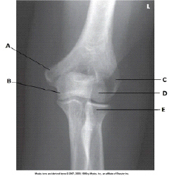 What anatomy is labeled as letter C in the image below?