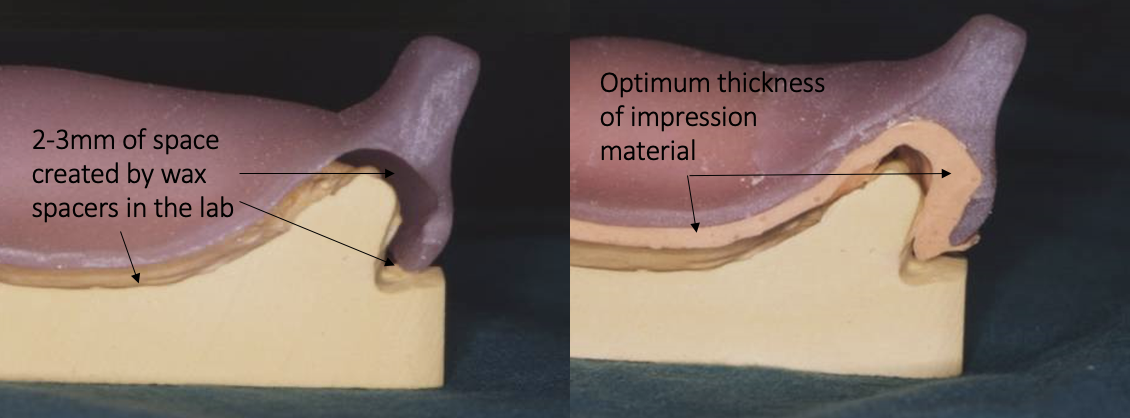 <p>outline a spaced special tray </p>