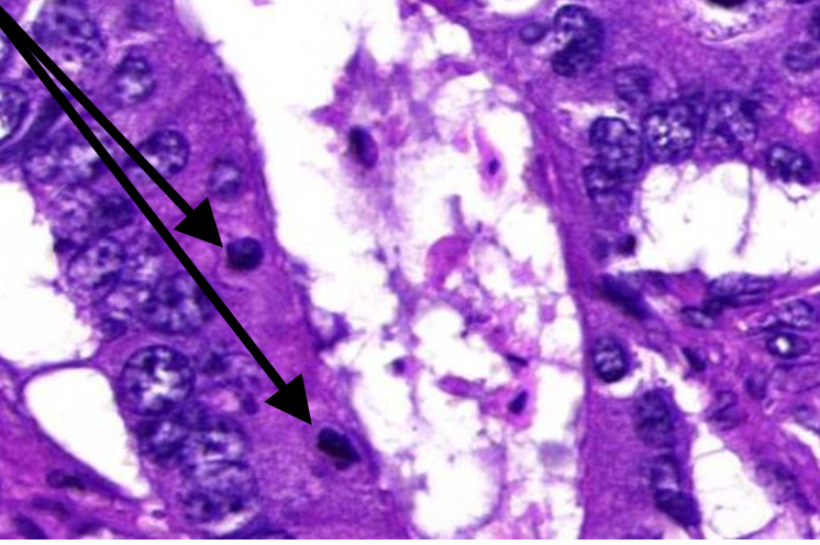 <p>wat wordt er aangeduid, rectum/colon</p>