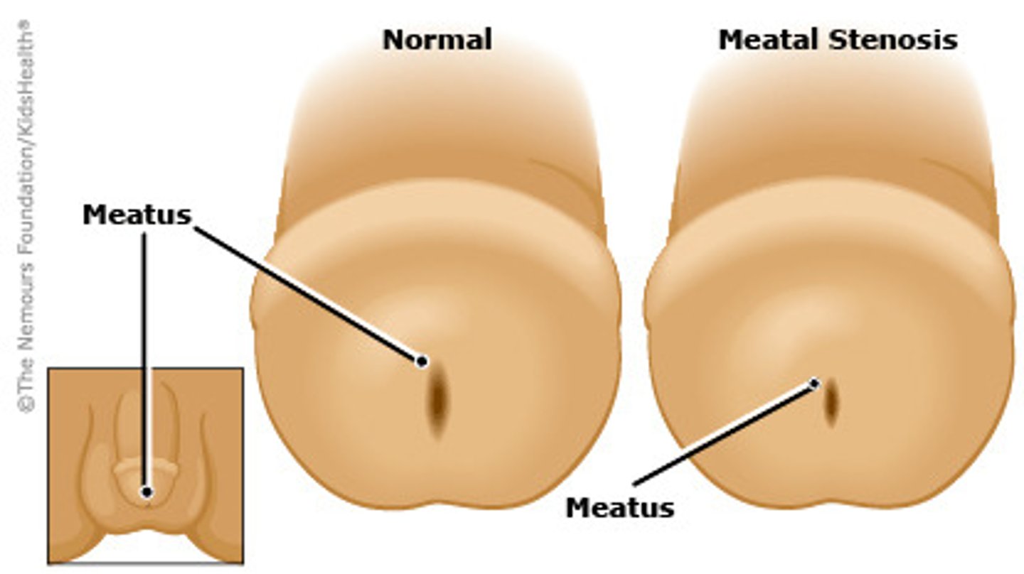 <p>Meatus</p>