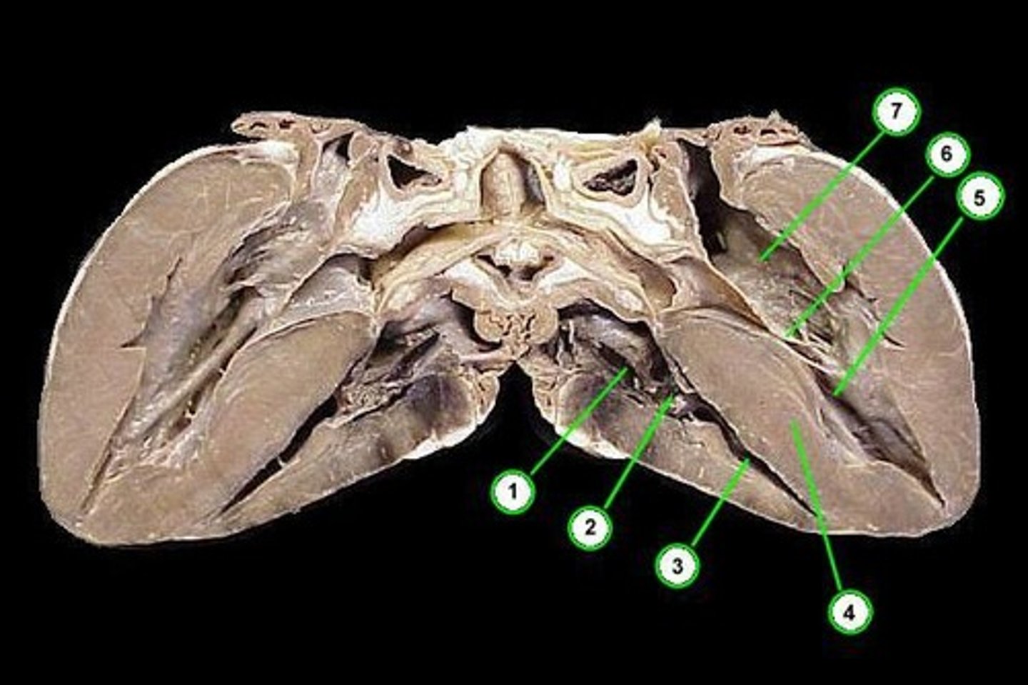 <p>location on #5</p>