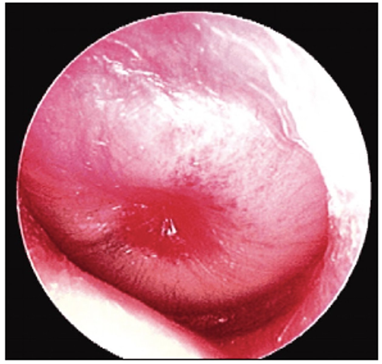 <p>-What is this dx of the following image?</p>