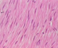 <p>muscle found inside many<strong> internal organs</strong> of the body that causes their movement (ex: <strong>stomach muscle</strong>)</p><ul><li><p>involuntary</p></li><li><p>smooth</p></li></ul><p></p>