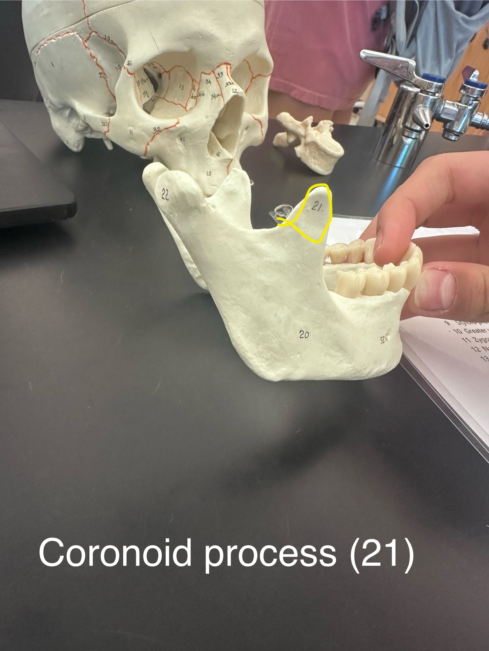 <p>Coronoid Processes of mandible</p>