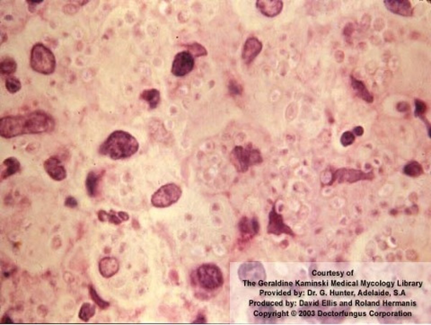 <p>(Yeast form)</p>