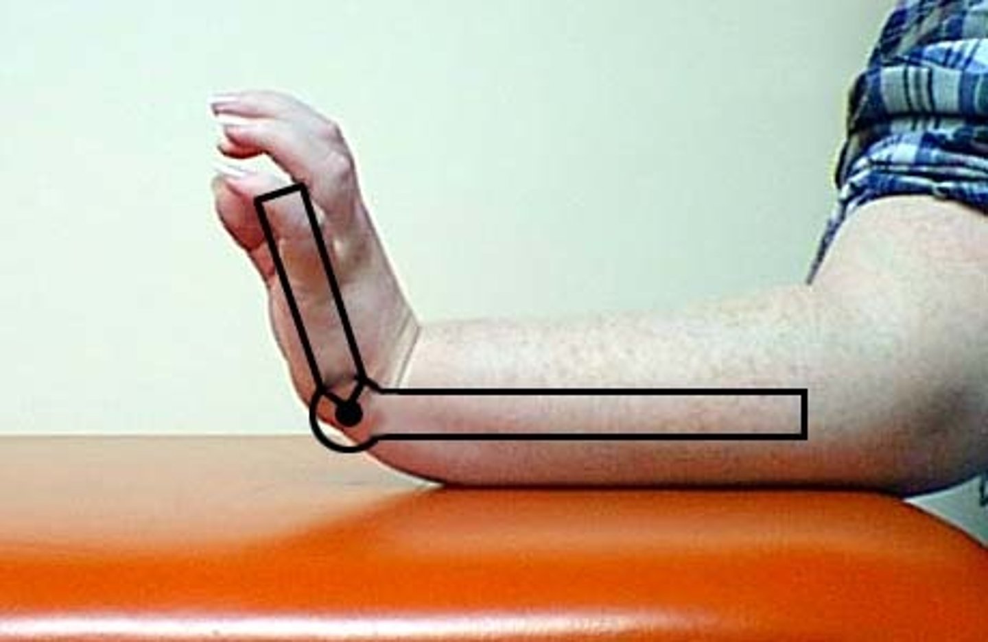 <p>fulcrum: lateral triquetrum<br>proximal: lateral midline of ulna (olecranon process for reference)<br>distal: lateral midline of 5th metacarpal<br><br>* arm on table at 90 degrees, wrist and hand off table with palm facing ground<br>* fingers flexed<br>* normal value = 70</p>