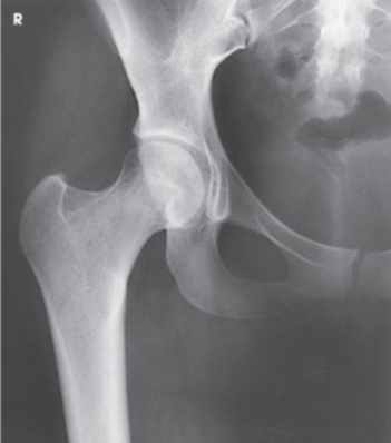 <p>What is the projection and anatomy shown in this image?</p>