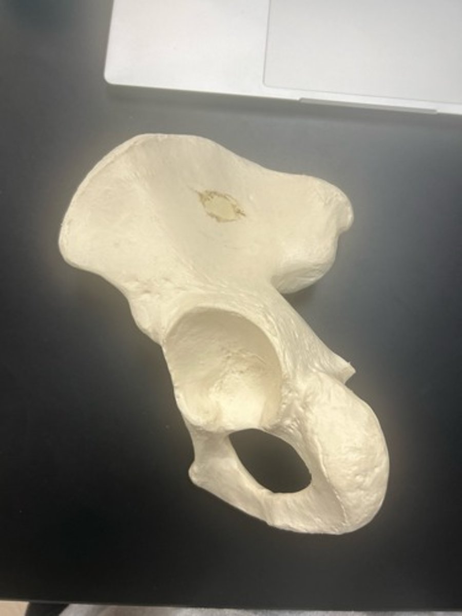 <p>name the bone</p>