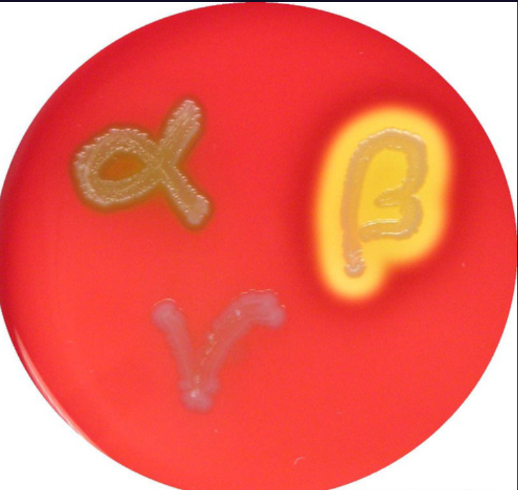 lysis of red blood cells in agar (beta-hemolysis), conversion of red blood cells to green (alpha-hemolysis), no effect on red blood cells (gamma-hemolysis)
