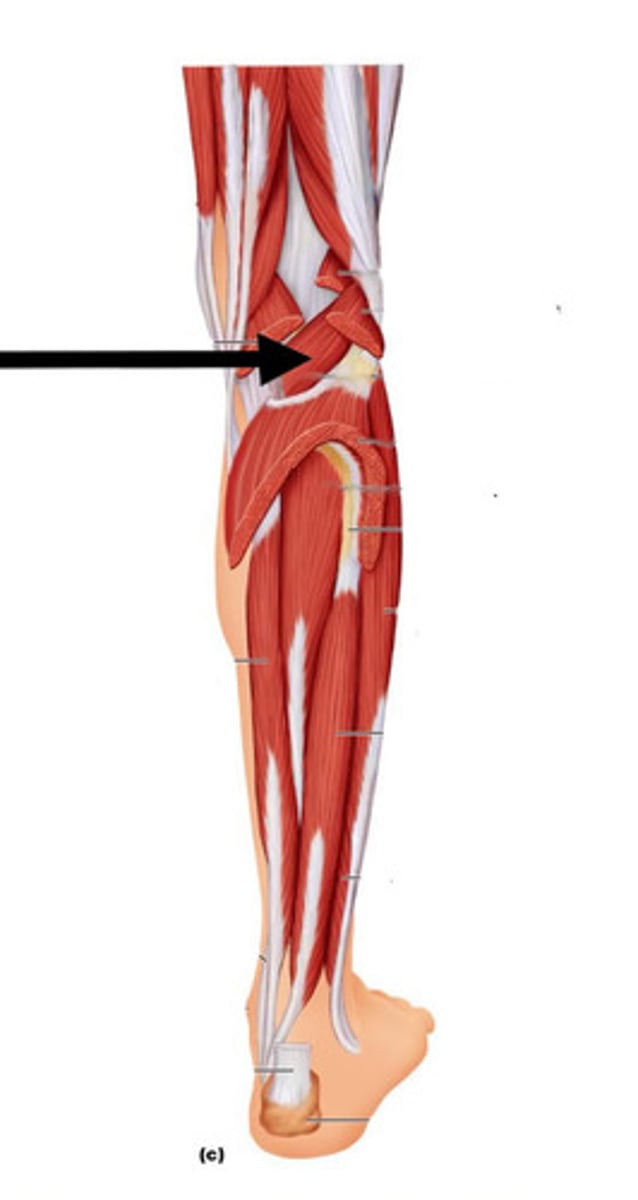 <p>O: Lateral condyle of the femur</p><p>I: Posterior surface of proxilmal tibia</p><p>A: Flex leg; rotate leg</p>