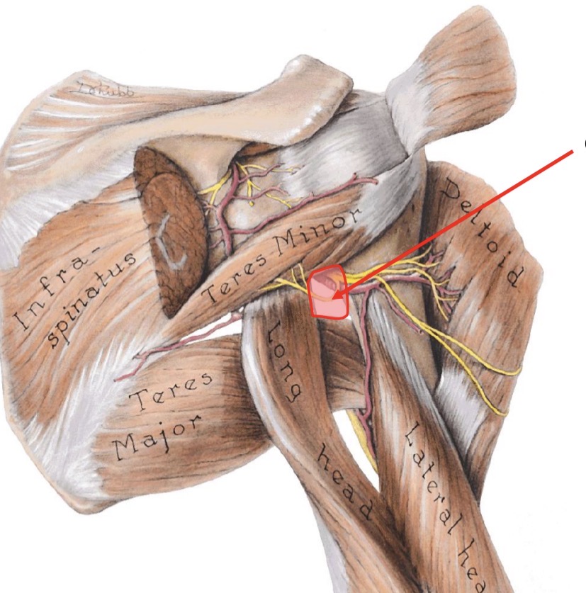 <p>medial border of quadrangular space</p>