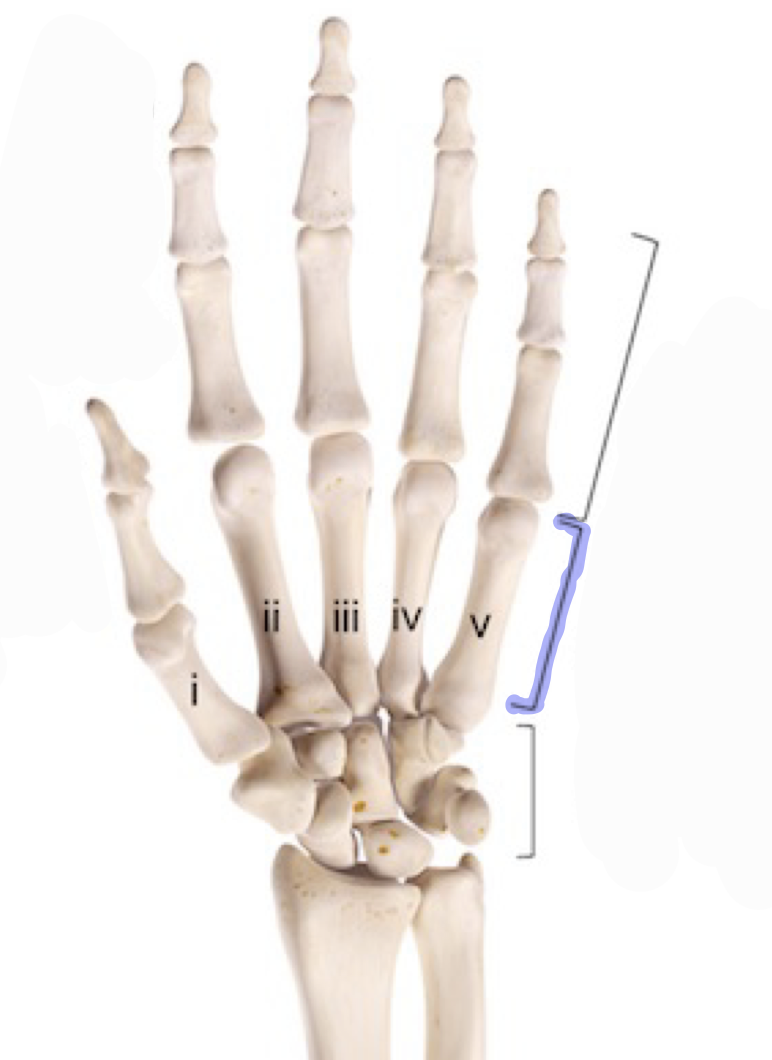 <p>5 bones that make up palm of each hand</p>