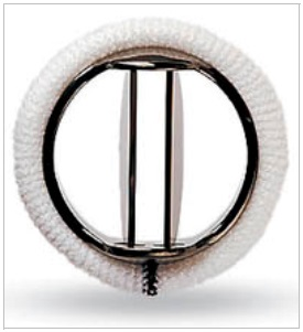 <p>chlopenní plastiky</p><ul><li><p>oprava chlopně</p></li></ul><p>chlopenní náhrady</p><ul><li><p>výměna chlopně</p></li><li><p>mechanické</p><ul><li><p>ze slitin ušlechtilých kovů a umělých hmot</p></li><li><p>nepodléhají opotřebení</p></li><li><p>vyžadují trvalou antikoagulační léčbu</p></li></ul></li><li><p>biologické</p><ul><li><p>z upravené zvíření tkáně (prasečí, hovězí)</p></li><li><p>podléhají opotřebení</p></li><li><p>nevyžadují antikoagulační léčbu</p></li></ul></li></ul><p></p>