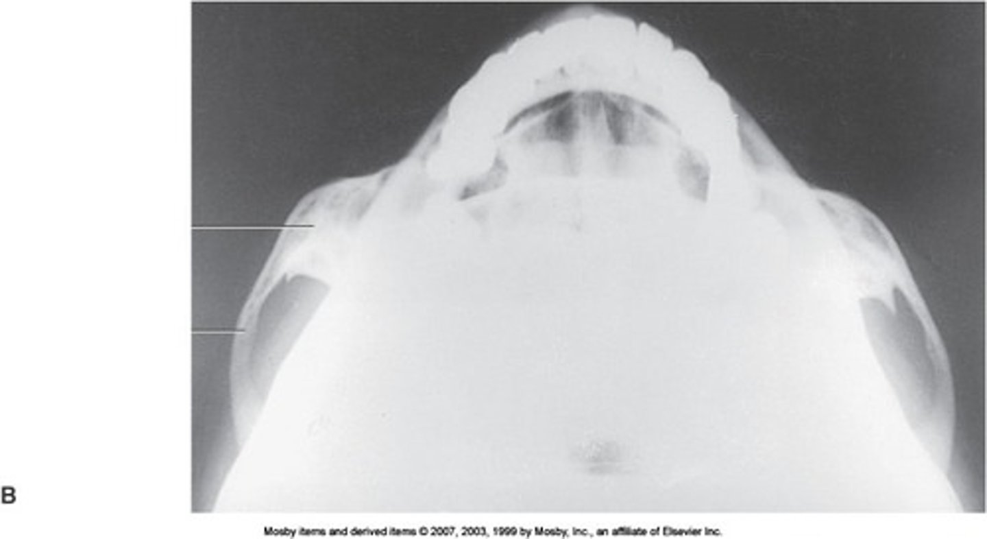 <p>What is this projection?</p><p>How is Patient positing?</p><p>What is the CR?</p><p>What are the structures shown?</p>