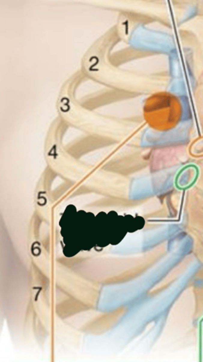 <p>second intercostal space; right sternal border.</p><p>During S2</p>