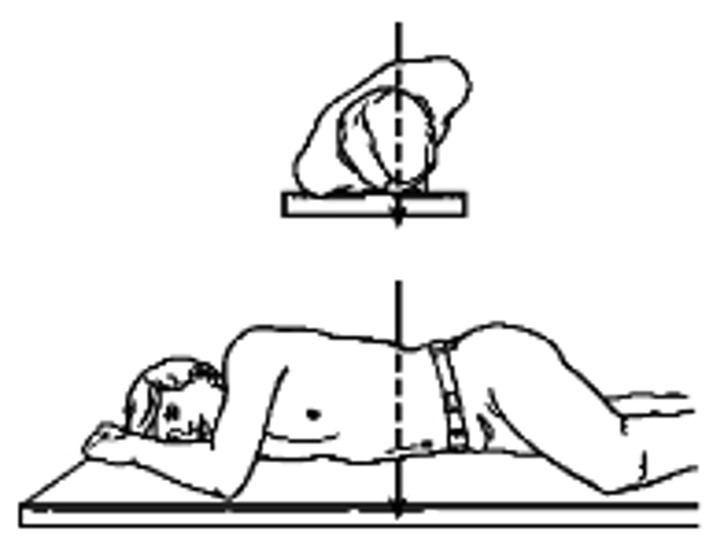 <p>What type of projection is this?</p><p>a. Right AP Oblique</p><p>b. Right PA Oblique</p><p>c. Left AP Oblique</p><p>d. Left PA Oblique</p>