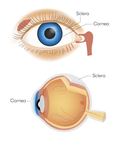 <p><strong>Fibrous tunic</strong></p><p>Fibrous connective tissue, poorly vascularised. Has 2 regions: the <strong>sclera </strong>and the <strong>cornea</strong></p>
