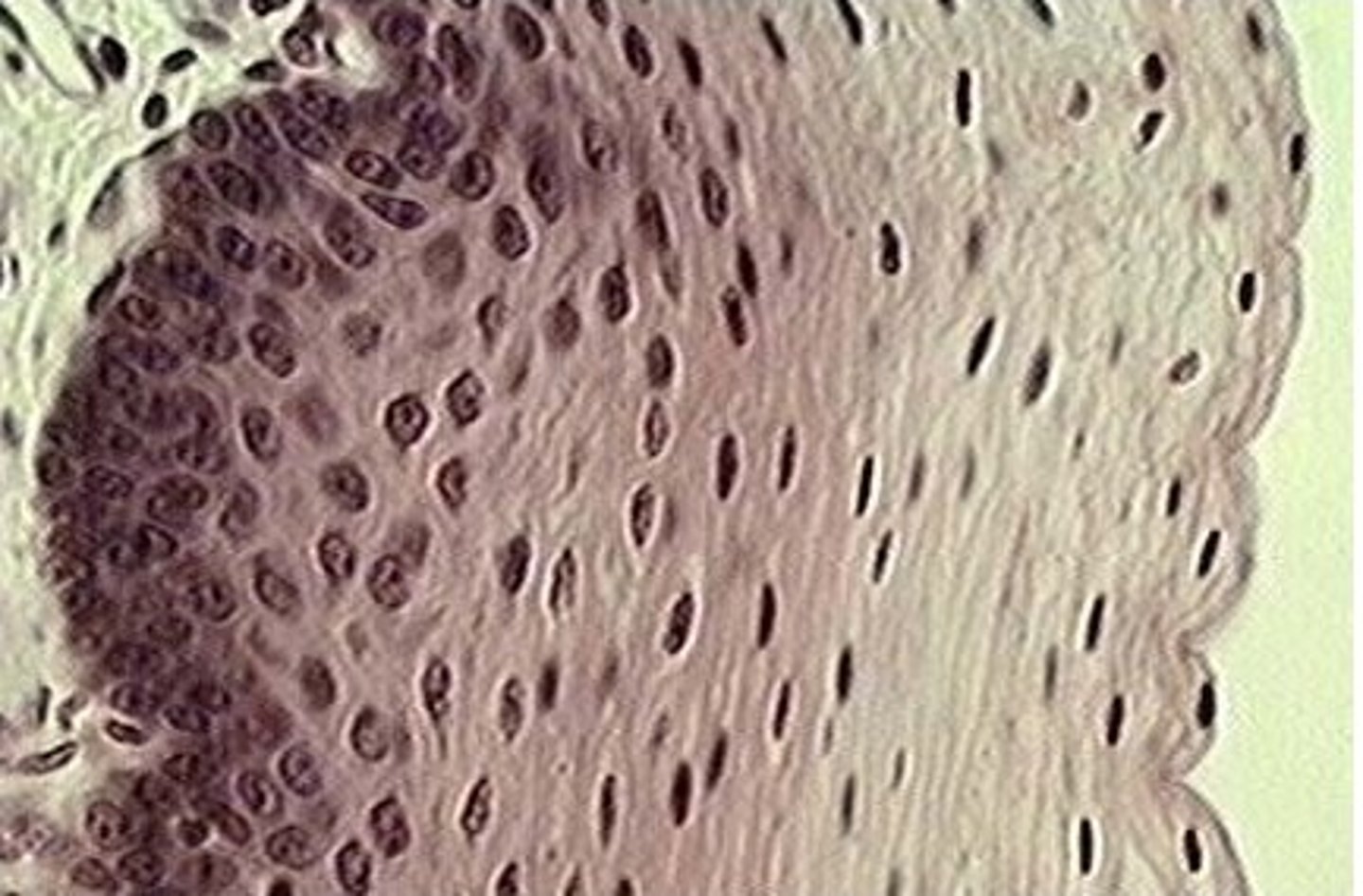 <p>Upper esophagus</p>