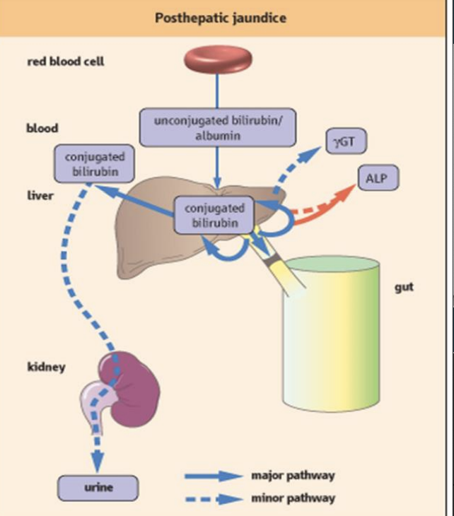 <p>A type of jaundice caused by obstruction of bile flow after bilirubin has been processed by the liver, leading to elevated conjugated bilirubin levels in the blood. </p>