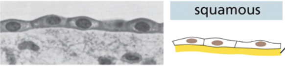 <ul><li><p>Individual cells are thin and horizontal</p></li></ul><ul><li><p><span style="background-color: transparent;"><span>Cells form a singular flat layer</span></span></p></li></ul><p></p>