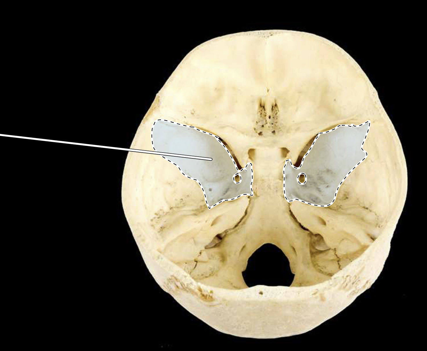 <p>Name the highlighted portion.</p><p>(Posterosuperior view of cranial cavity).</p>