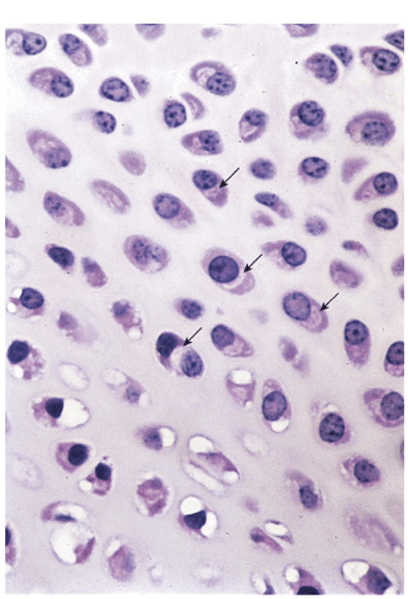 <p>How does an active chondrocyte appear under light microscopy? (3)</p>