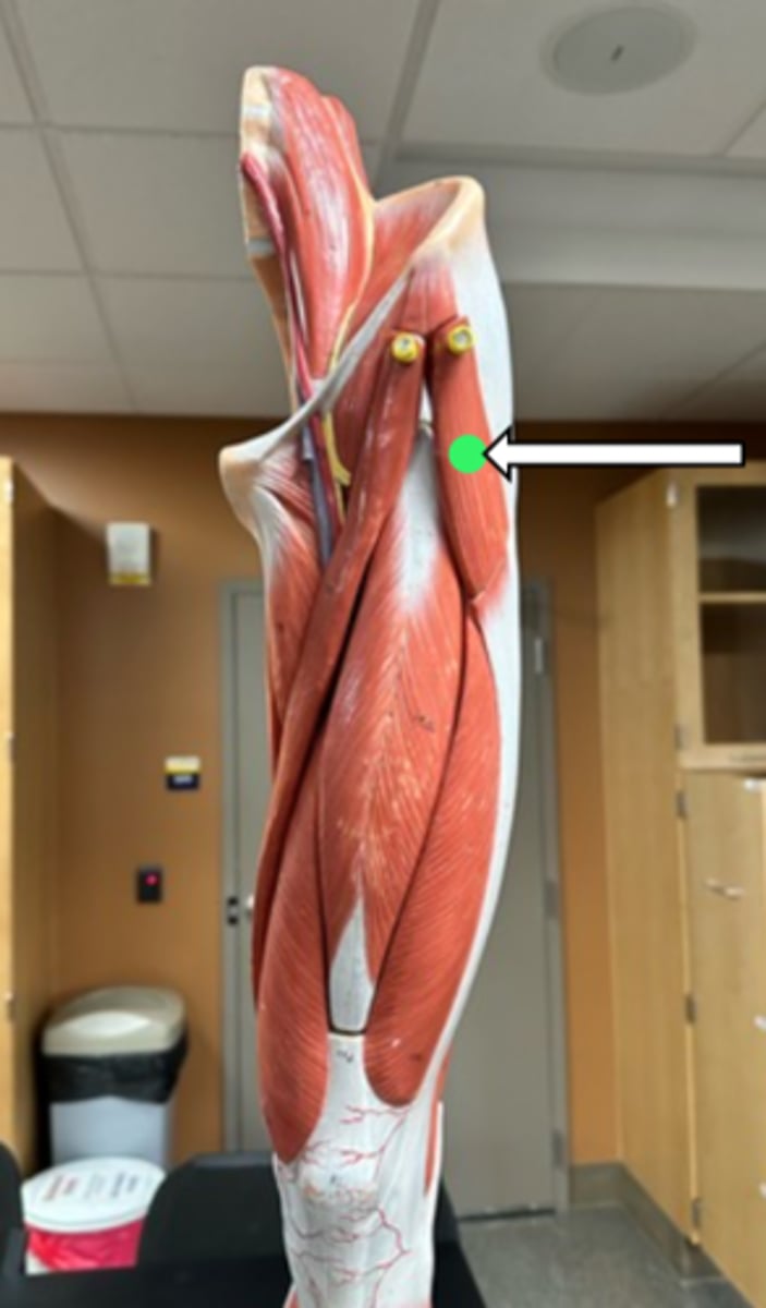 <p>tensor fasciae latae (function)</p>