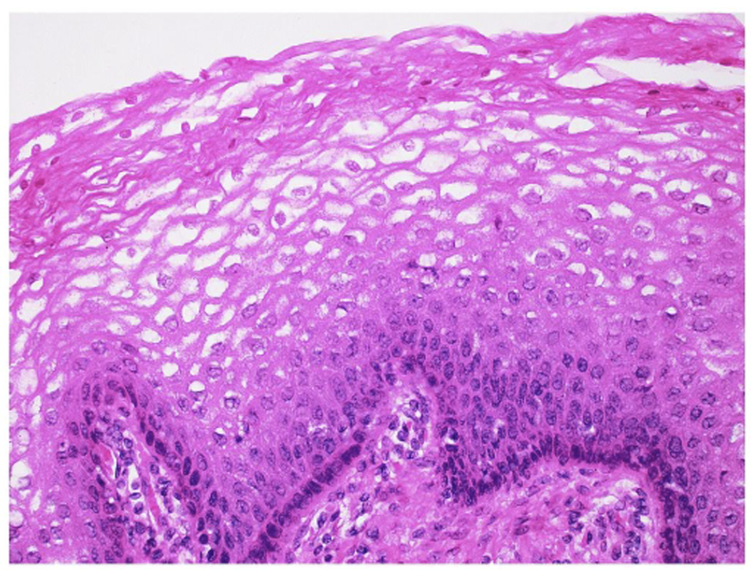 <p>Stratified squamous epithelium.</p>