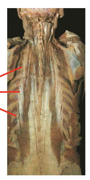 <p>what is this muslce. What is its origin. Where does it inserts. </p>
