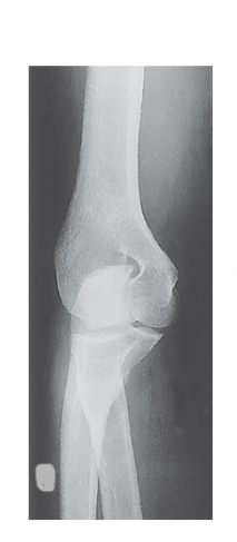 <p>What projection was taken to obtain this image? R or L?</p>