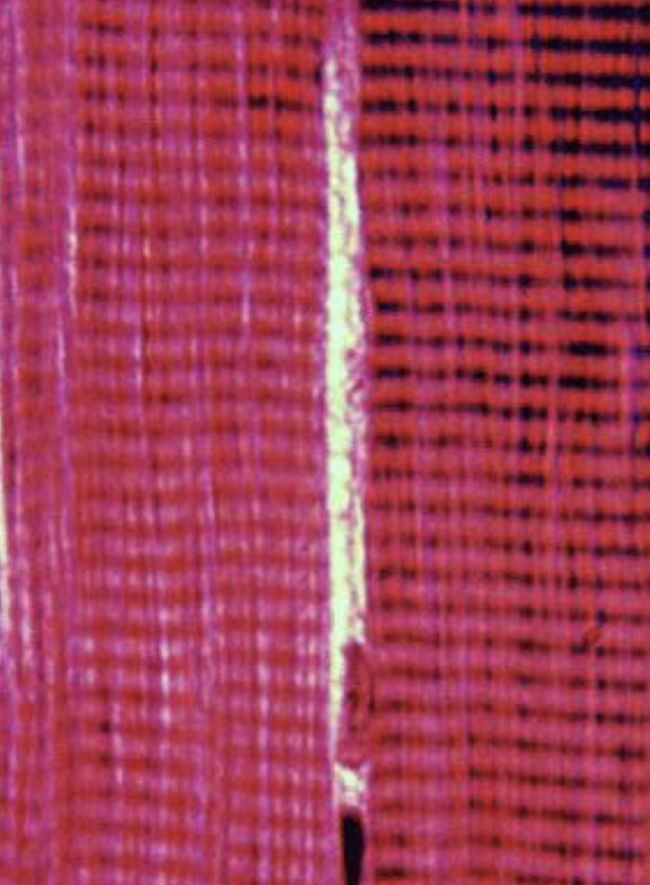 <p>Skeletal muscle </p>