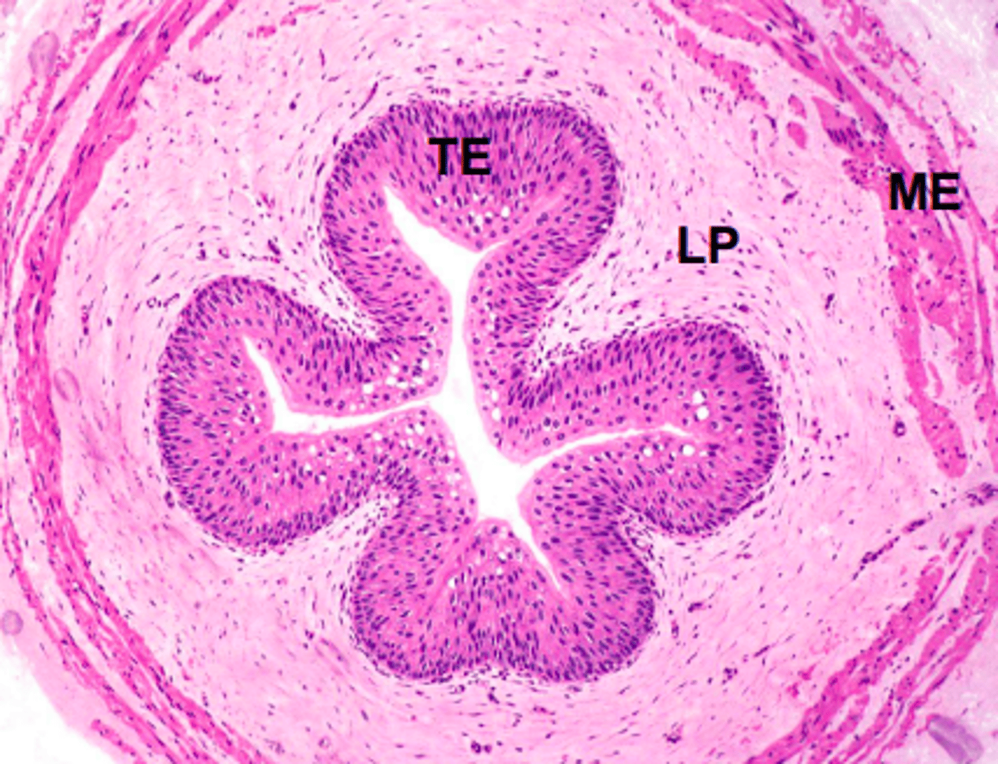 <p>TE = Transitional epithelium</p><p>LP = Fibroelastic lamina propria</p><p>ME = Muscularis externa</p>